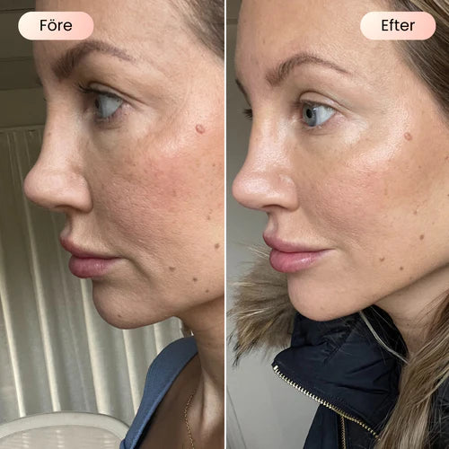 Dermalume Skinboosting LED Mask